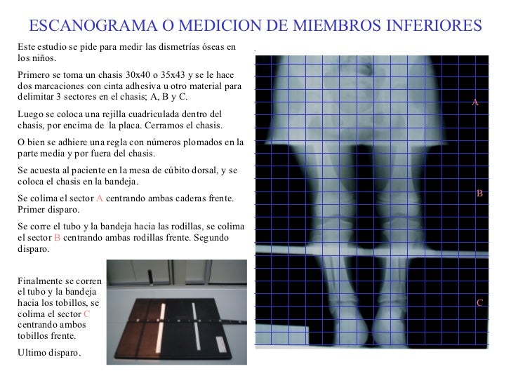 Medicion Real Y Aparente De Miembros Inferiores es.slideshare.net