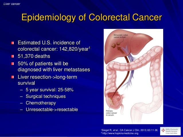 Colon Cancer Specialist In Georgia