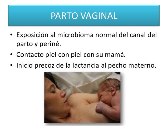Distinguir el pecho de silicio de presente