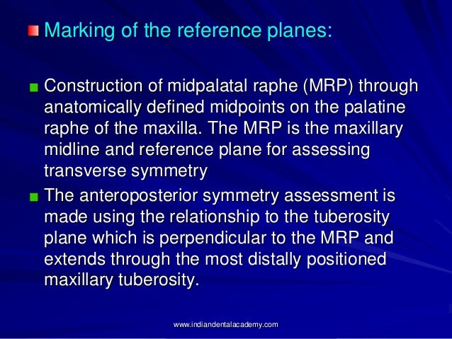 an analysis of the differences between the mrp one and mrp two What are different mrp types there are one more type of mrp xo which planning can done what's the difference between mrp vs mps. an analysis of the differences between the mrp one and mrp two What are different mrp types there are one more type of mrp xo which planning can done what's the difference between mrp vs mps.