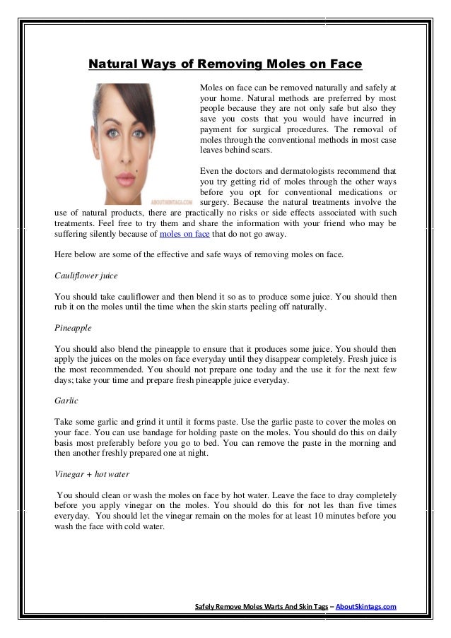 Best Way To Remove Moles On Face Naturally Best Way To Remove Moles On Face Naturally