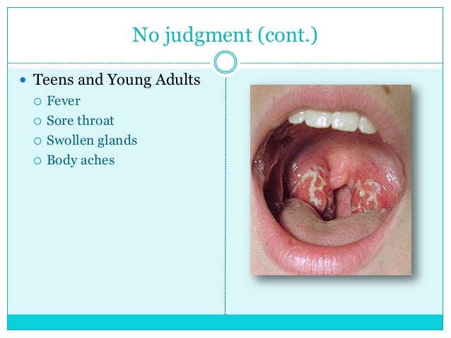 mono symptoms in adults mono symptoms in adults