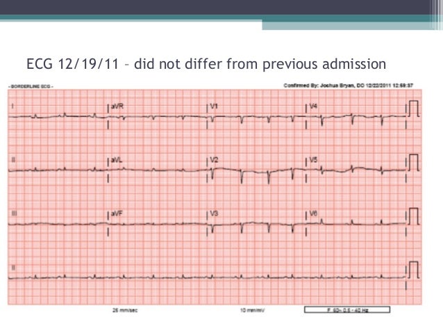 Asbestos exposure laundry asbestos constructing legal guidelines