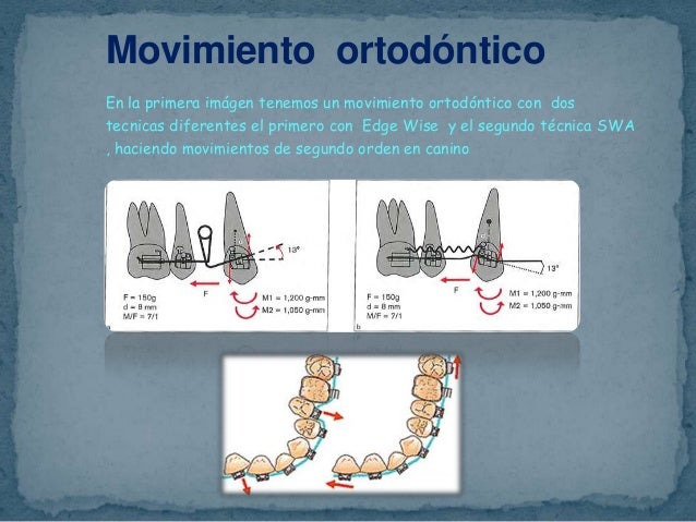 Movimiento dental seminario 4