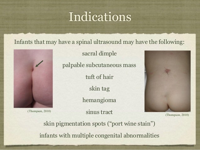 mucus and sinus sinus drainage mucus in throat