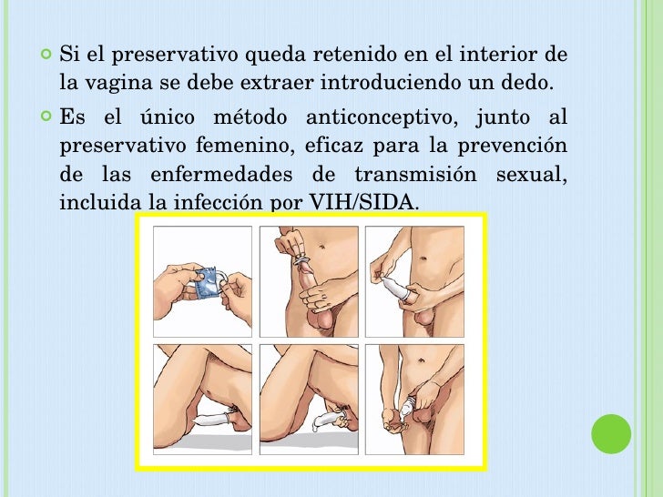 El aumento del miembro por medio de las hierbas