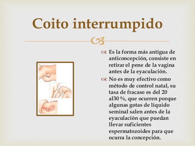 Métodos anticonceptivos