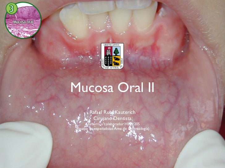 La Mucosa Oral 120