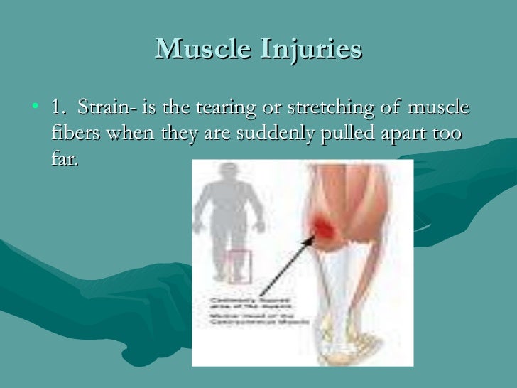 Muscular System Disease
