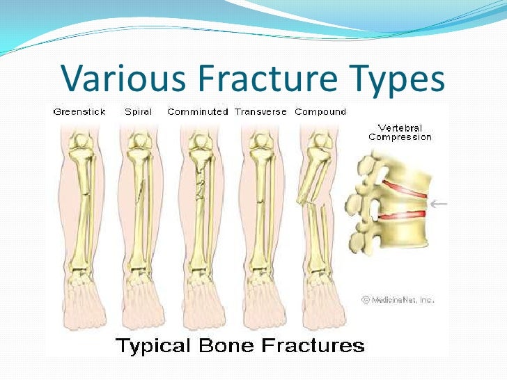 Musculoskeletal System: Fractures