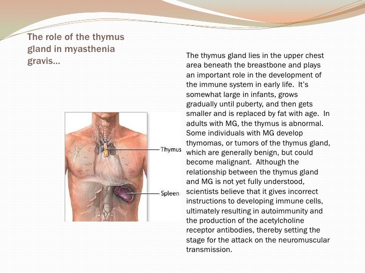 Myasthenia Gravis