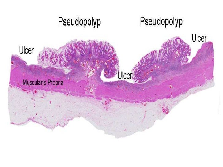 Kartoffelsalat cineplex turned into koche ich heute we love family