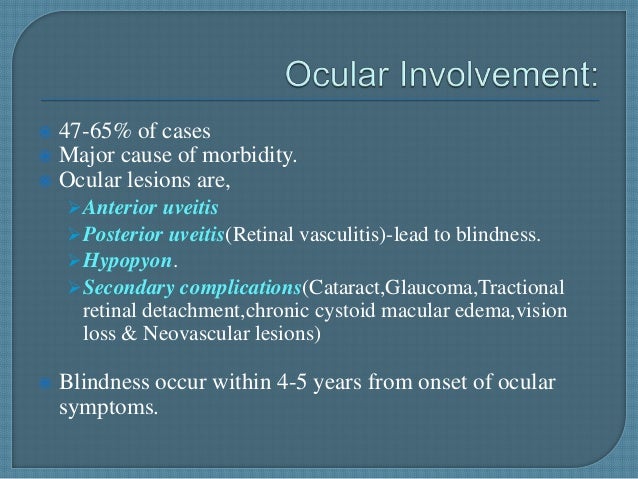 behcets disease
