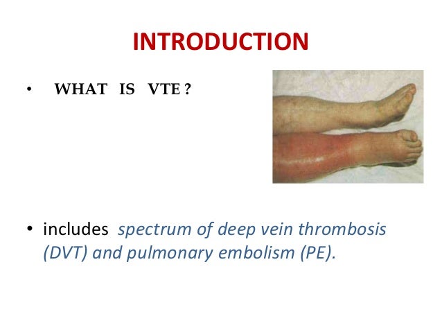 DVT PROPHYLAXIS IN ORTHOPEDIC SURGERIES