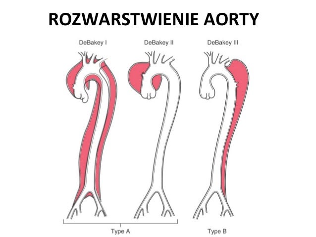 patologia-naczy