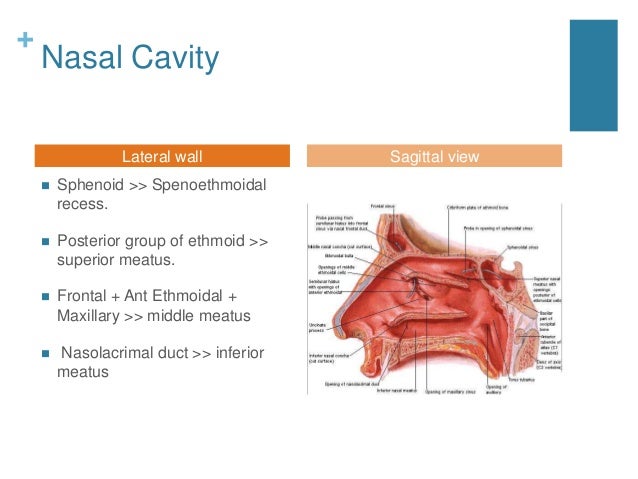 Continual Maxillary Sinusitis Wiki
