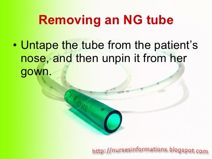 Nasogastric Tube (NGT) insertion and removal