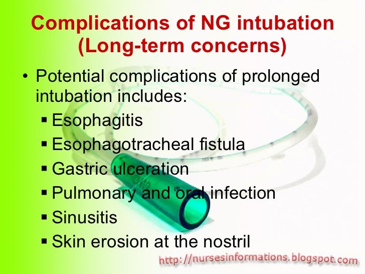 Nasogastric Tube (NGT) insertion and removal