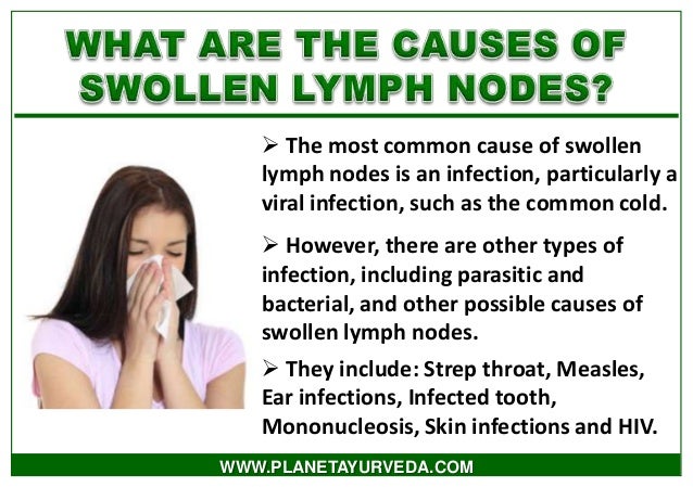 Swollen Lymph Nodes Neck Natural Treatment Swollen Lymph Nodes Neck Natural Treatment