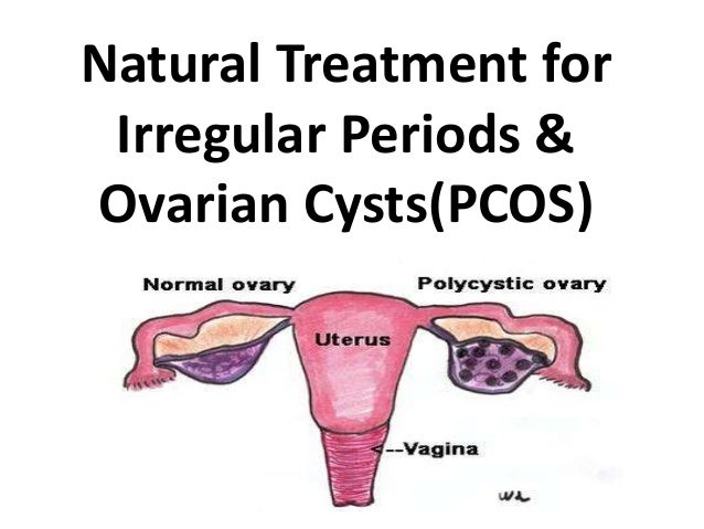 Polycystic Ovary Syndrome Natural Treatment In Hindi Polycystic Ovary Syndrome Natural Treatment In Hindi