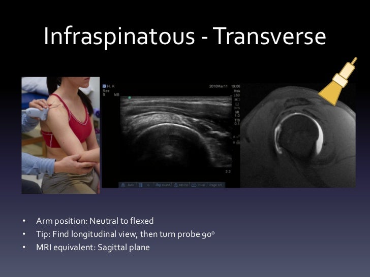Ultrasound Shoulder