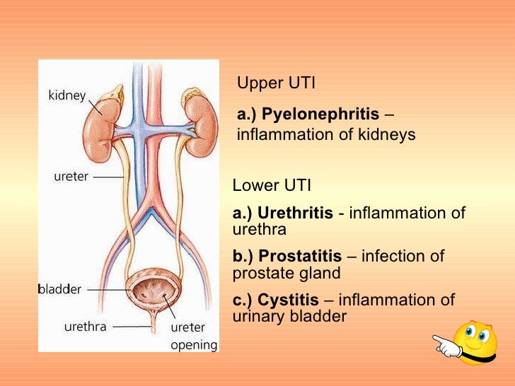 Cipro Urinary Tract Infections