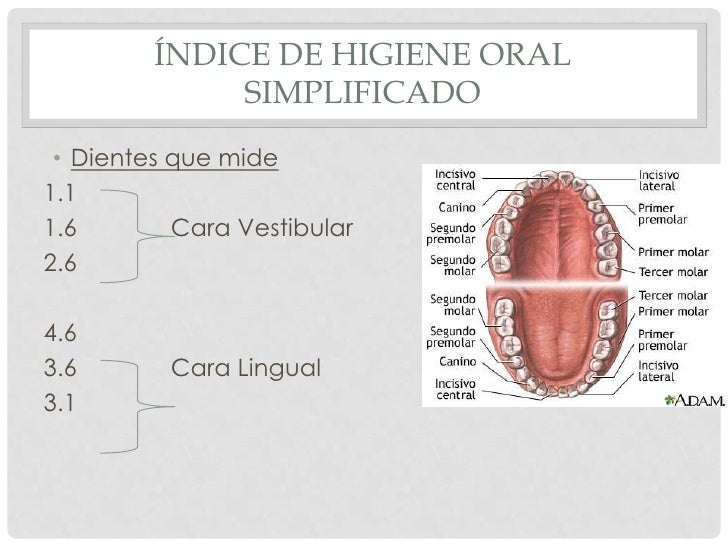 íNdice de higiene oral simplificado de greene y vermillon
