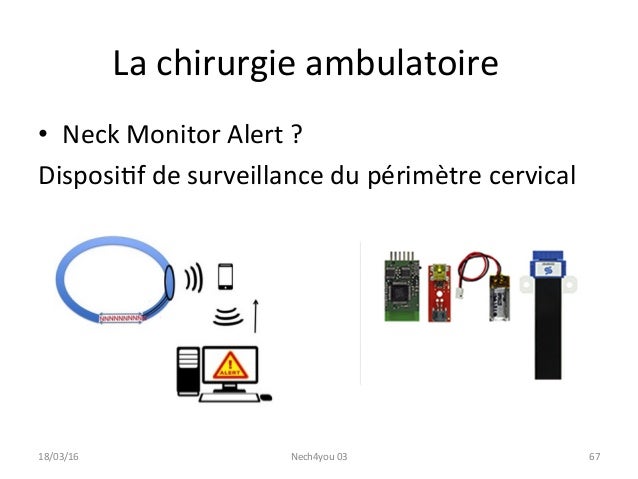 Cancer Du Cavum Prise En charge
