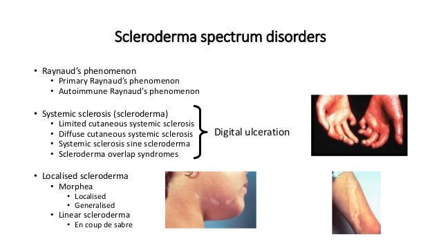 Mometasone furoate ointment usp 0.1 price