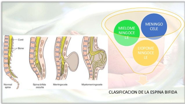 Ha vuelto bruscamente el cuello el dolor vivo