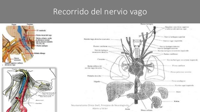 Nervio glosofaríngeo y nervio Vago