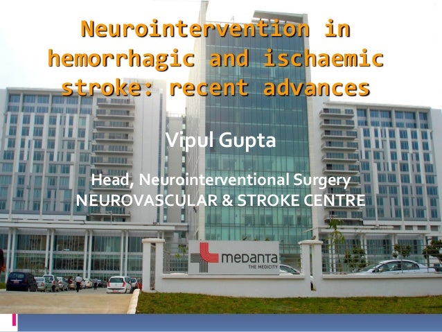 Act speedy on stroke stroke remedy pdf