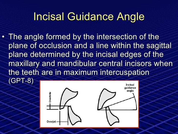 Neutrocentric Concept (prosthodontics)