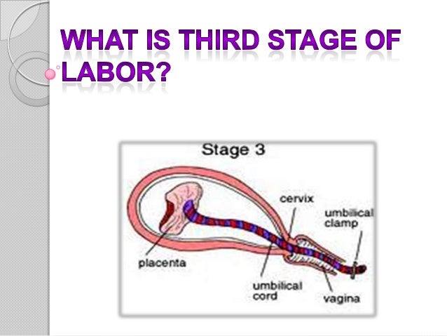 3rd and 4th stage of labor In the fourth stage of labor, the nurse observed that the client has a full bladder the nurse knows that this increases the risk of what postpartum complication a. 3rd and 4th stage of labor In the fourth stage of labor, the nurse observed that the client has a full bladder the nurse knows that this increases the risk of what postpartum complication a.