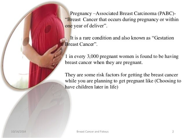Personal story breast cancer