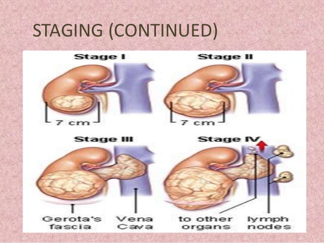 triple terrible breast most cancers treatment set of rules