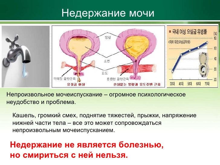 Недержание мочи у мужчин : лечение, причины, препараты и народные средства Недержание мочи у мужчин : причины, лечение, народные средства
