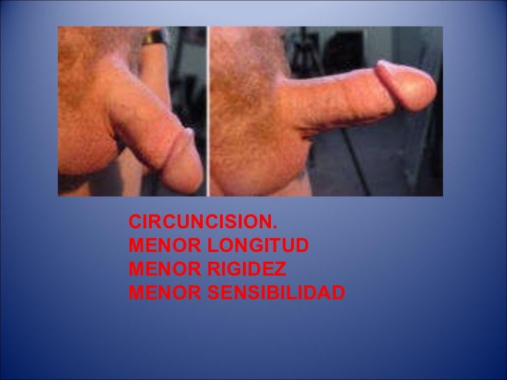 La pompa para el aumento del pene por las manos
