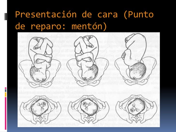 Nomenclatura, Pelvis
