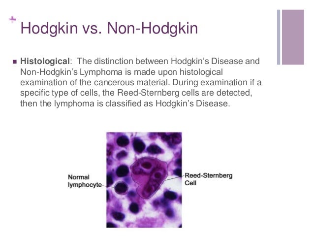 Non Hodgkins Lymphom Bei Erwachsenen Symptome