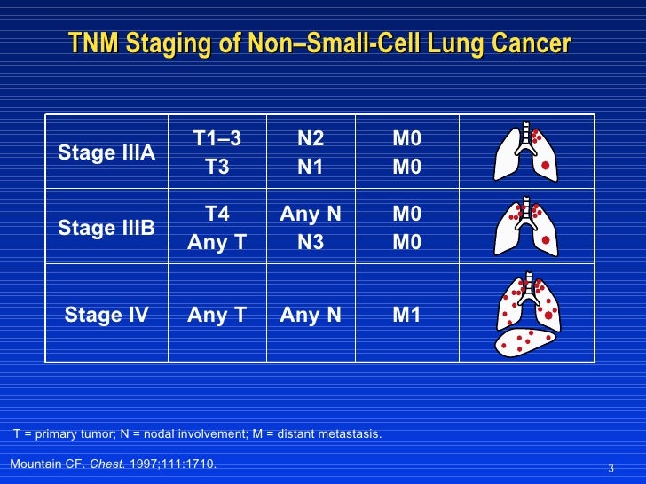 Superior most cancers remedy options