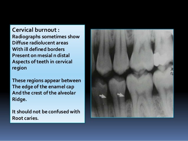 Cervical Cap