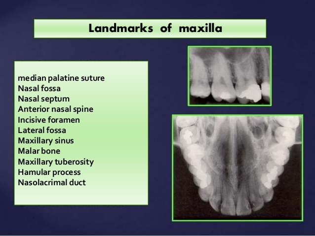 Normal Radiographic Anatomical Landmarks