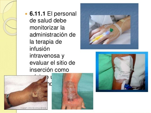 Norma Oficial De Terapia De Infusión es.slideshare.net