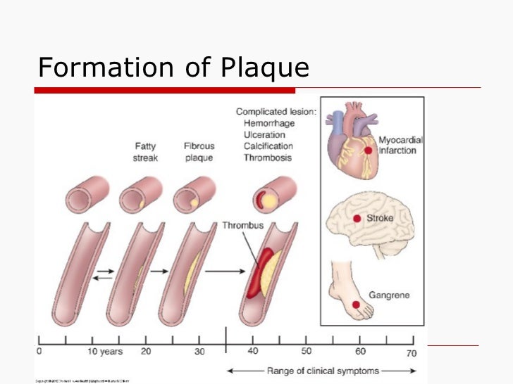 Plavix and viagra