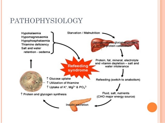 ogilvie syndrome