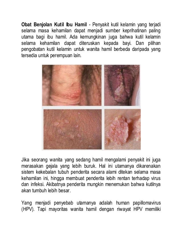 obat benjolan kutil ibu obat benjolan kutil ibu