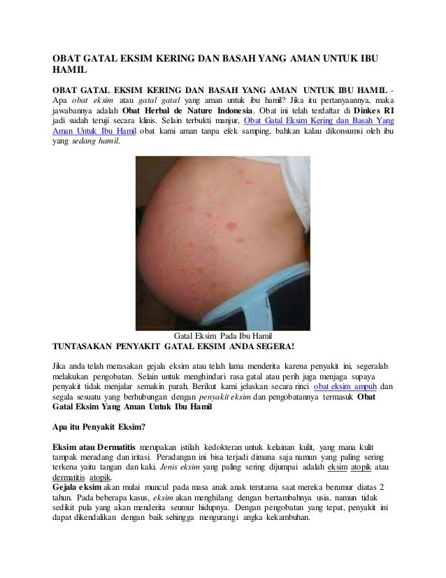 obat gatal eksim kering dan basah yang aman untuk ibu obat gatal eksim kering dan basah yang aman untuk ibu