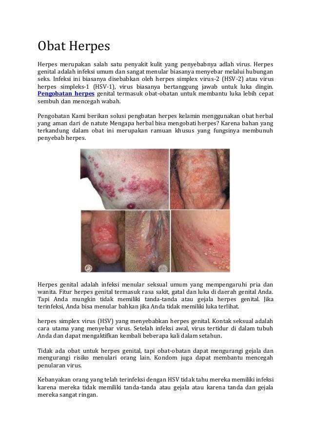 obat herpes obat herpes
