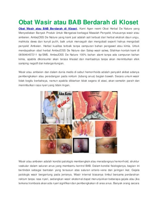 obat wasir atau bab berdarah di kloset obat wasir atau bab berdarah di kloset